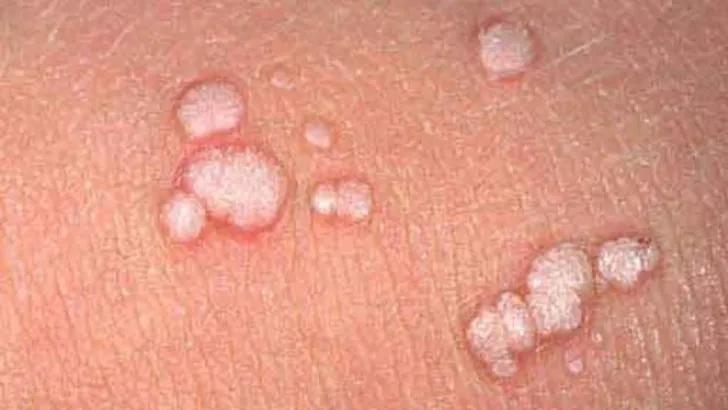 genitalsigil-1920w genitalsigil-1920w