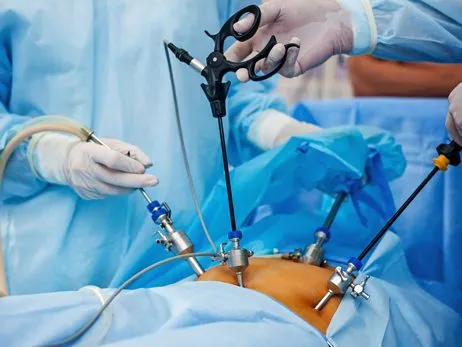 laparoskopik-cerrahi-baharcaglar-1920w laparoskopik-cerrahi-baharcaglar-1920w